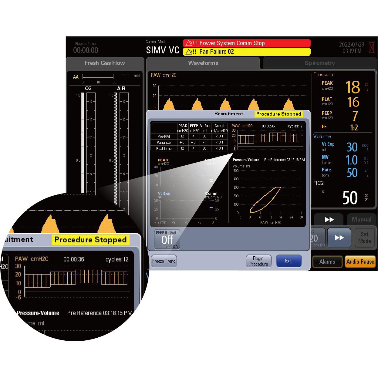 WATO EX65 Pro Vet Standard Anesthesia Machine – O₂ & Air, 0681E-PA00005