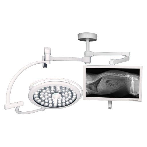 Medical Illumination System Two LED - DUO- One 130K Lux Light & One Monitor Arm (SD2M1)