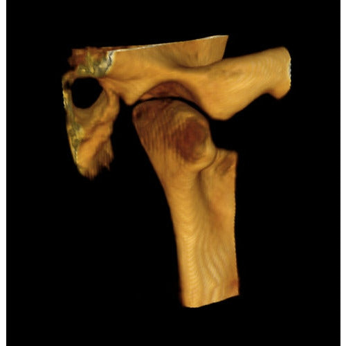 CARESTREAM CS 9300 SELECT PANOREX + CONE BEAM