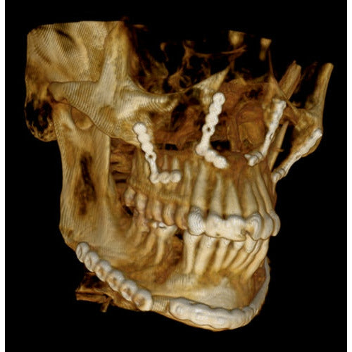 Carestream CS 9300 Premium Panorex + Cone Beam
