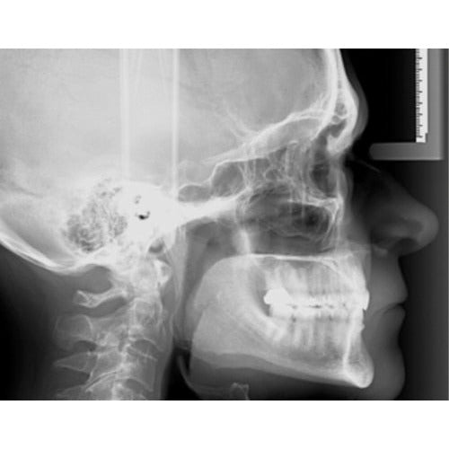GENDEX GXDP-700 PANOREX + CEPH + CONE BEAM