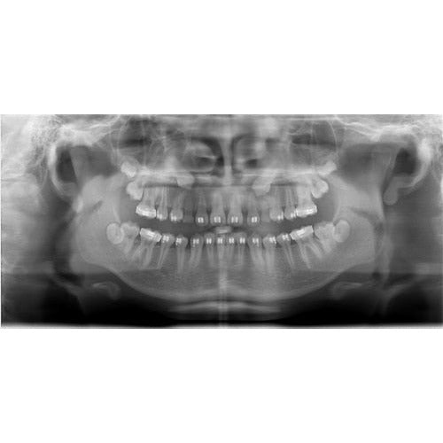 GENDEX CB-500 CONE BEAM