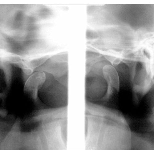 CARESTREAM CS 9000C 3D PANOREX + CEPH + CONE BEAM