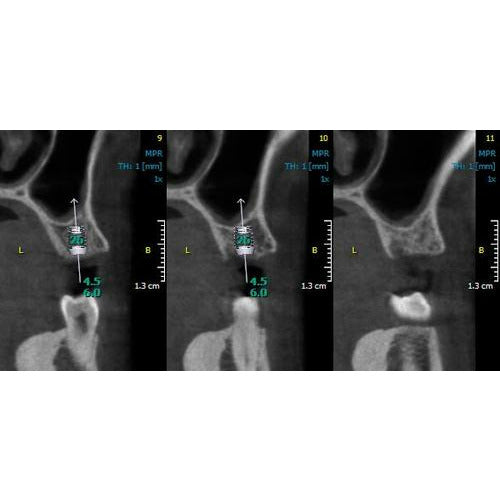 GENDEX GXDP-700 PANOREX + CONE BEAM