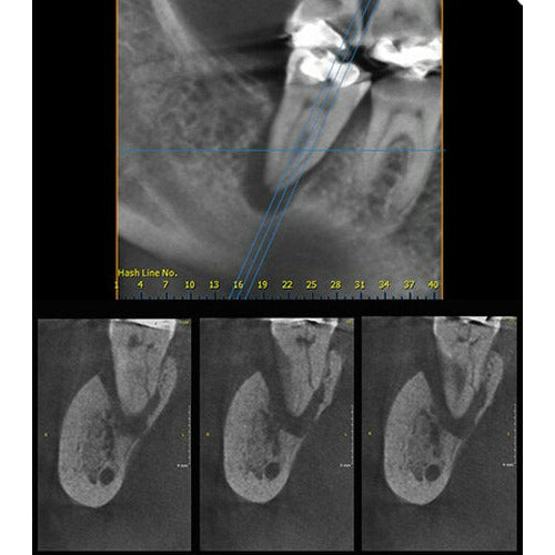 GENDEX GXDP-700 PANOREX + CONE BEAM