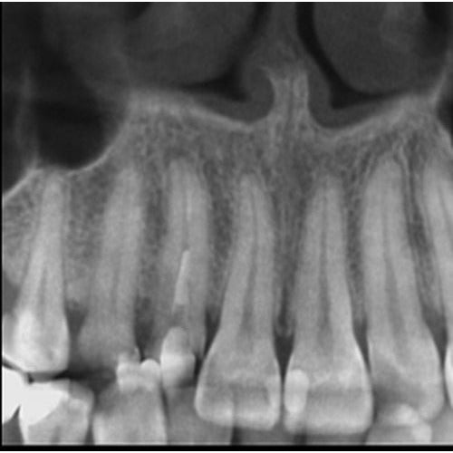 GENDEX GXDP-700 PANOREX + CONE BEAM