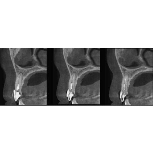 GENDEX GXDP-700 PANOREX + CONE BEAM