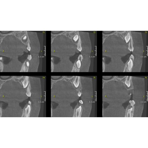 GENDEX GXDP-700 PANOREX + CONE BEAM