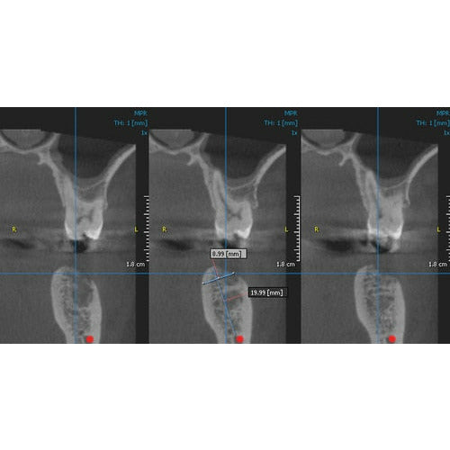 GENDEX GXDP-700 PANOREX + CONE BEAM