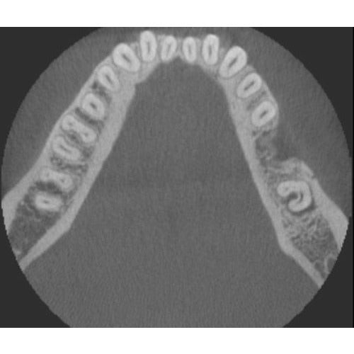 GENDEX GXDP-700 PANOREX + CONE BEAM
