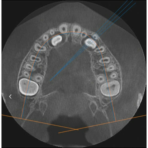 GENDEX GXDP-700 PANOREX + CONE BEAM