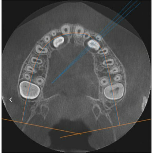 GENDEX GXDP-700 PANOREX + CEPH + CONE BEAM