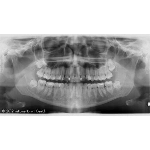 GENDEX GXDP-700 PANOREX + CEPH + CONE BEAM