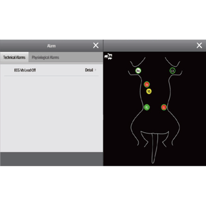 Mindray Animal Monitor ePM12Vet