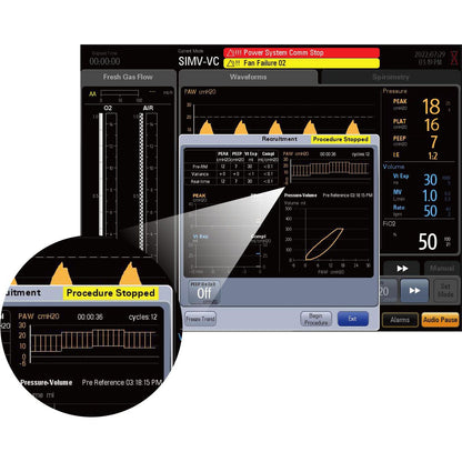 Mindray WATO EX65 Pro Vet Standard Anesthesia Machine – O₂, Air & N₂O + Lung Recruitment