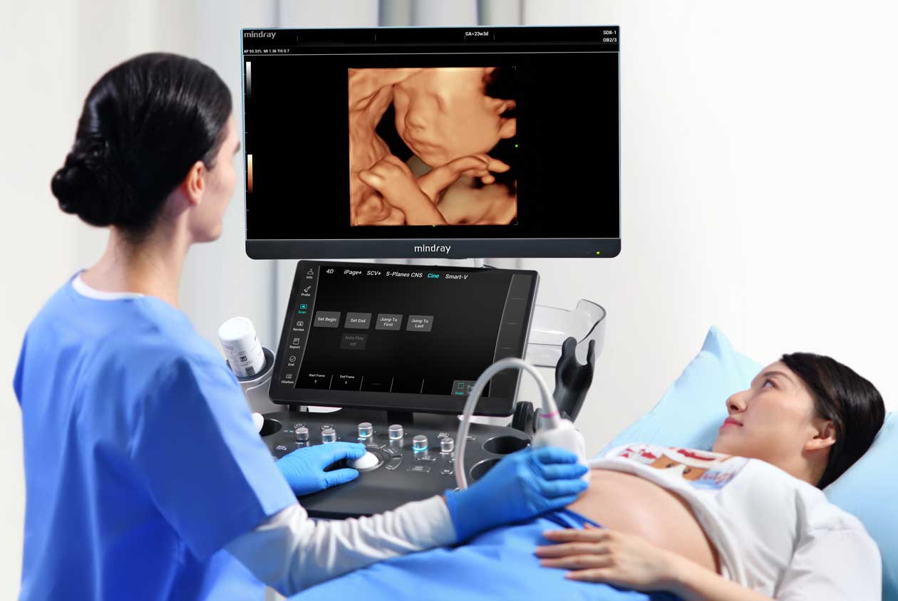 Mindray Consona N9 Diagnostic Ultrasound System, 2166E-PA00004