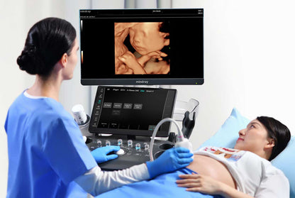 Mindray Consona N9 Diagnostic Ultrasound System, 2166E-PA00004