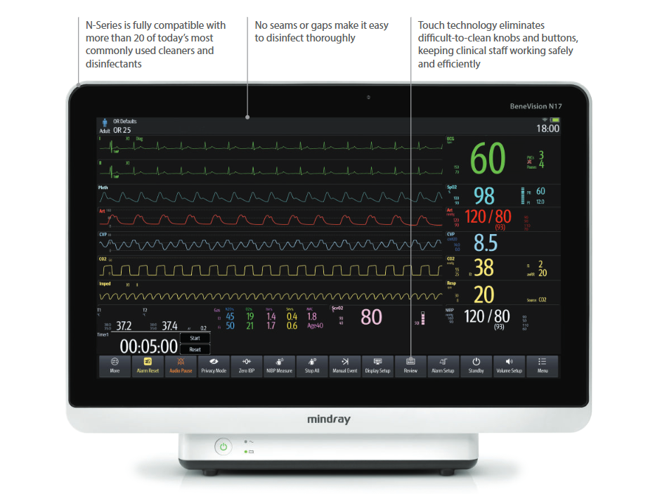 Mindray BeneVision N17 Patient Monitor