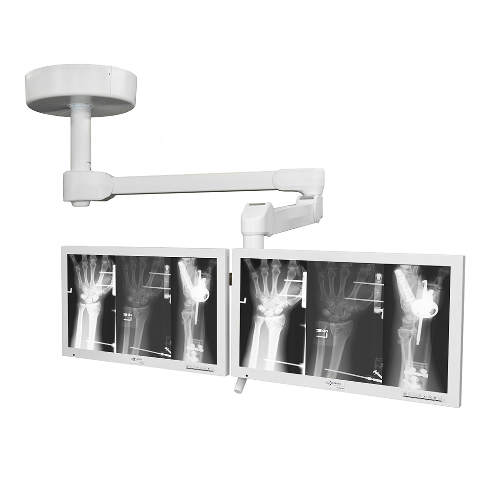 Nuvo Vu LED Surgical Light (160,000 Lux), NVSD3-E