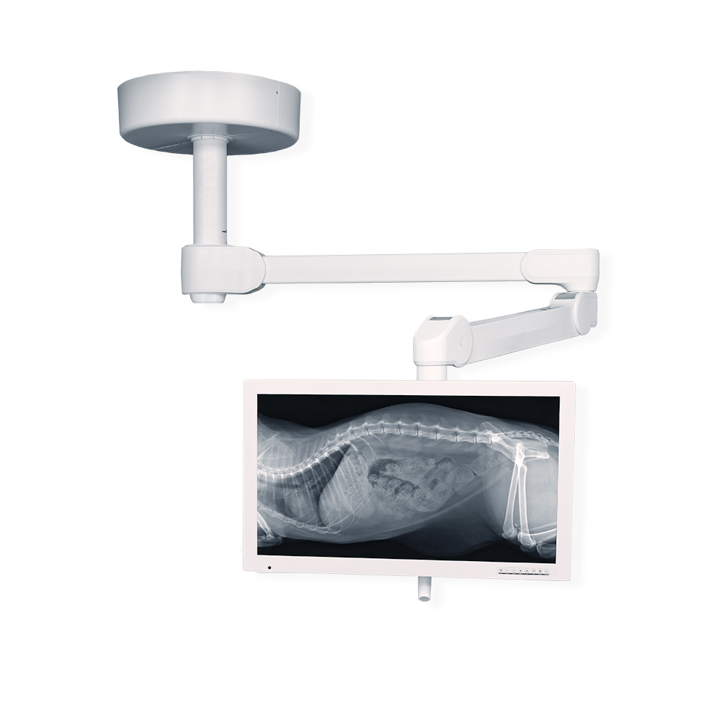 Medical Illumination System Two LED - SOLO - One Monitor Arm (SM1)