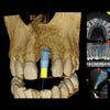 CARESTREAM CS 8100 3D PANOREX + CONE BEAM