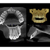 CARESTREAM CS 8100 3D PANOREX + CONE BEAM