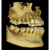 CARESTREAM CS 8100 3D PANOREX + CONE BEAM