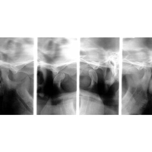 CARESTREAM CS 8100 3D PANOREX + CONE BEAM