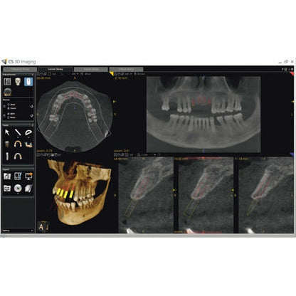 CARESTREAM CS 9300 SELECT PANOREX + CONE BEAM