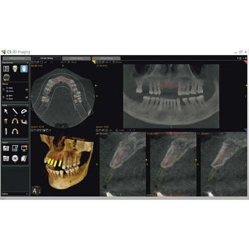 CARESTREAM CS 9300 SELECT PANOREX + CONE BEAM