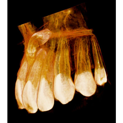 KODAK 9000 3D PANOREX + CONE BEAM