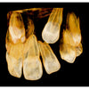 CARESTREAM CS 9000C 3D PANOREX + CEPH + CONE BEAM