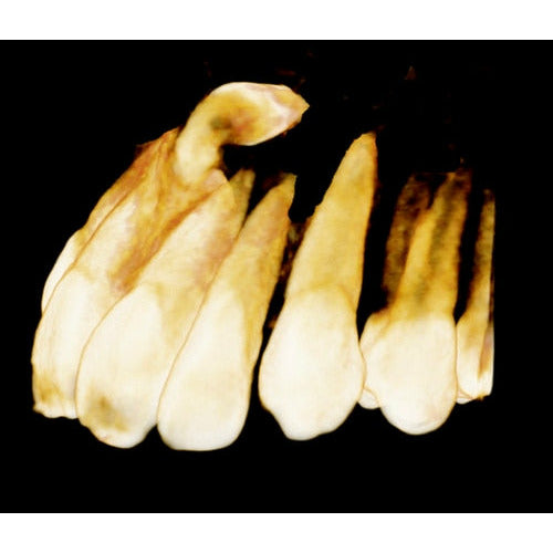 CARESTREAM CS 9000C 3D PANOREX + CEPH + CONE BEAM