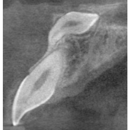 CARESTREAM CS 9000C 3D PANOREX + CEPH + CONE BEAM