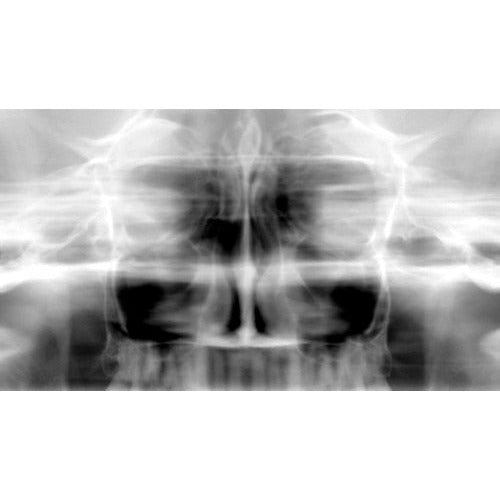 CARESTREAM CS 9000C 3D PANOREX + CEPH + CONE BEAM