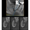 GENDEX GXDP-700 PANOREX + CEPH + CONE BEAM