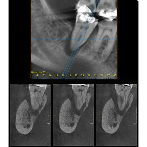GENDEX GXDP-700 PANOREX + CEPH + CONE BEAM