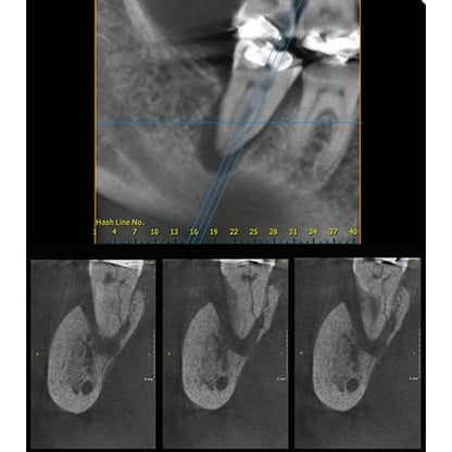 INSTRUMENTARIUM OP300 PANOREX + CONE BEAM