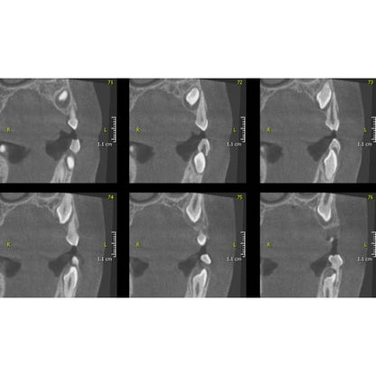 INSTRUMENTARIUM OP300 PANOREX + CONE BEAM