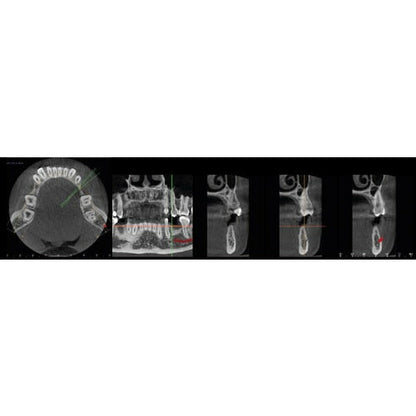 INSTRUMENTARIUM OP300 MAXIO PANOREX + CONE BEAM
