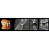 KAVO OP 3D PRO PANOREX + CONE BEAM