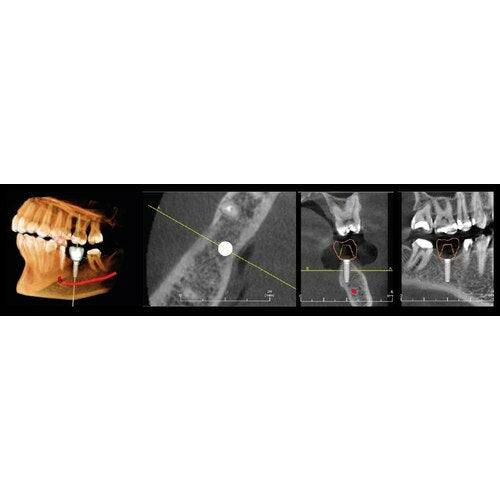 INSTRUMENTARIUM OP300 MAXIO PANOREX+CONE BEAM - LARGE FOV