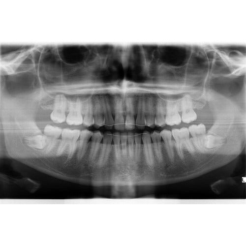 GENDEX GXDP-700 PANOREX + CEPH + CONE BEAM