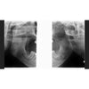 GENDEX GXDP-700 PANOREX + CEPH + CONE BEAM