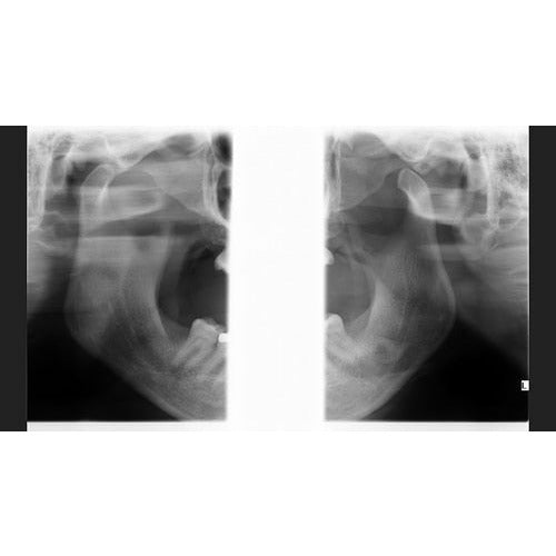 GENDEX GXDP-700 PANOREX + CEPH + CONE BEAM