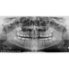 GENDEX GXDP-700 PANOREX + CONE BEAM