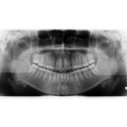 KAVO OP 3D PRO PANOREX CONE BEAM – HampMED