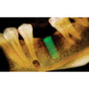 CARESTREAM CS 9000C 3D PANOREX + CEPH + CONE BEAM