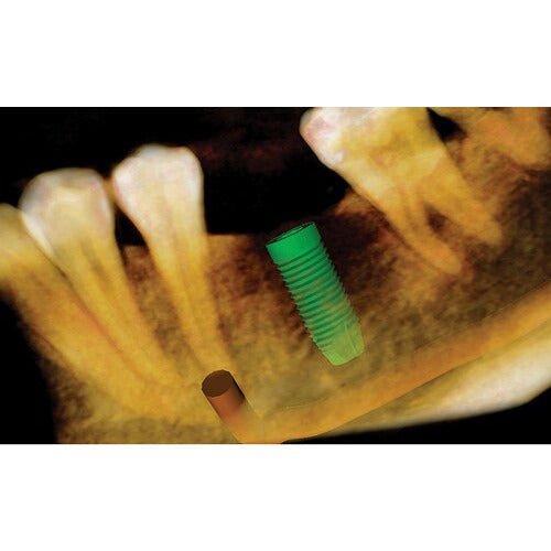 CARESTREAM CS 9000C 3D PANOREX + CEPH + CONE BEAM